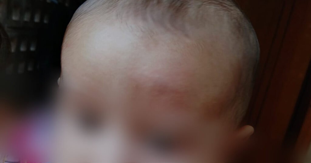 Bebê de 4 meses é atingida por vassourada durante confusão entre vizinhos em condomínio de Jundiaí